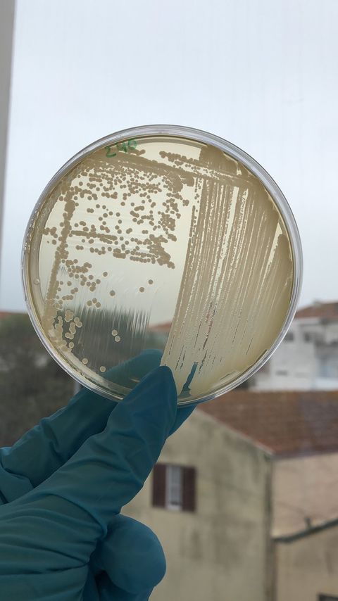 Acinetobacter – a bactéria hospitalar que está a causar infeções graves nos pacientes